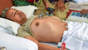 newdelhi अस्पताल में भर्ती होने के बाद भी अनशन पर कायम सोनम वांगचुक, शिक्षा मंत्री के इस्तीफे की मांग दोहराई