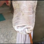bhagalpur पिता को सांप ने काटा तो बेटे ने जिंदा सांप को बोतल में बंद कर पहुंचाया अस्पताल, देखने उमड़ी भीड़
